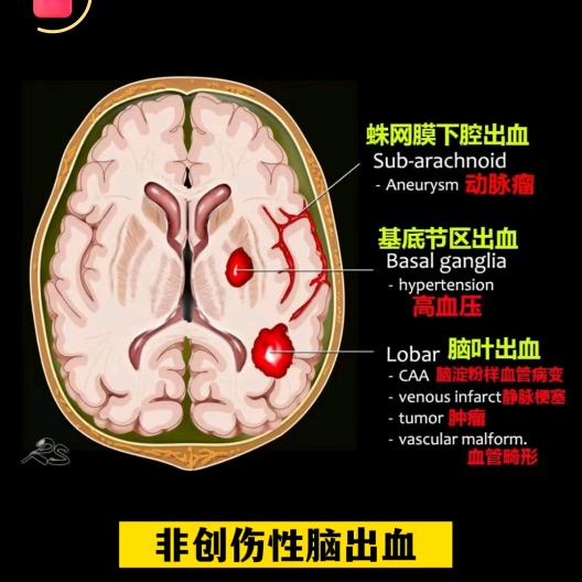 歇不下的康复师