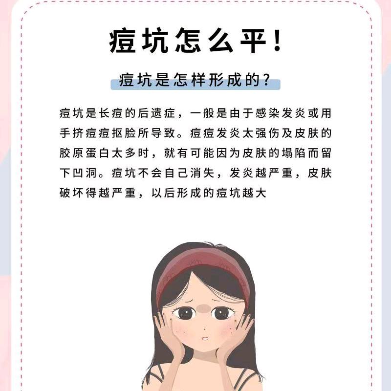 范范痘肌痘坑（可拿货教直播）