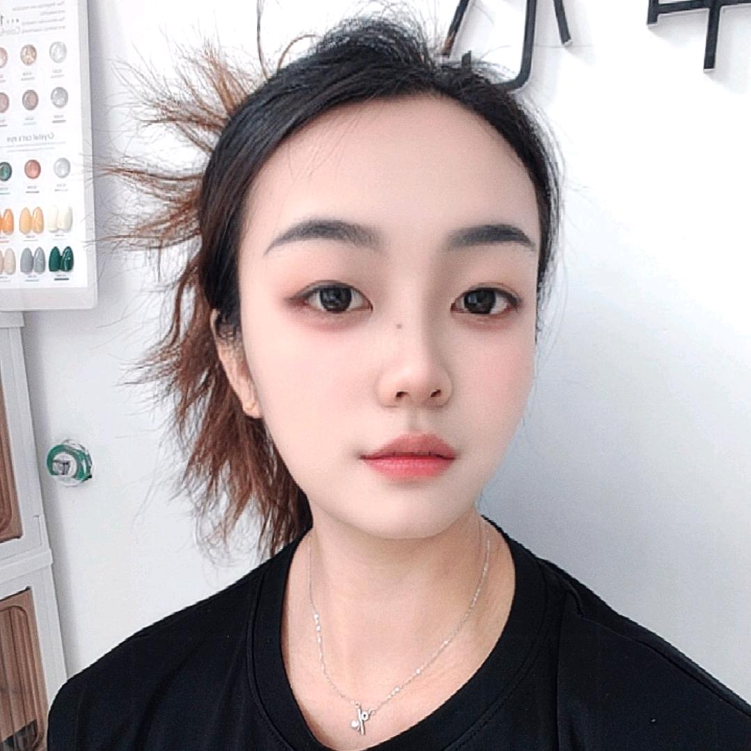 小英  皮肤管理（斑敏痘 痣疣）