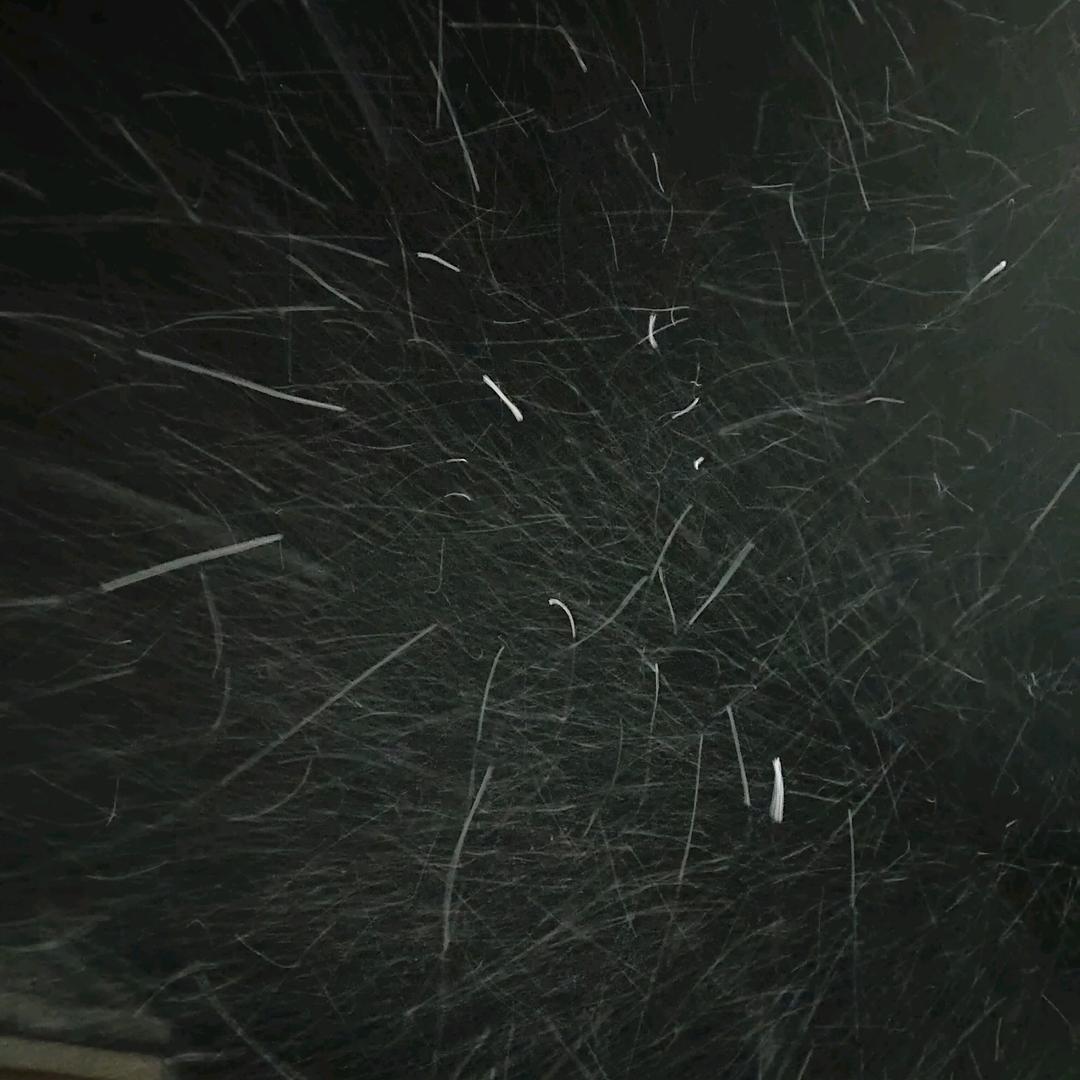 泪痣.^