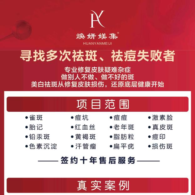 我是一棵小虎牙