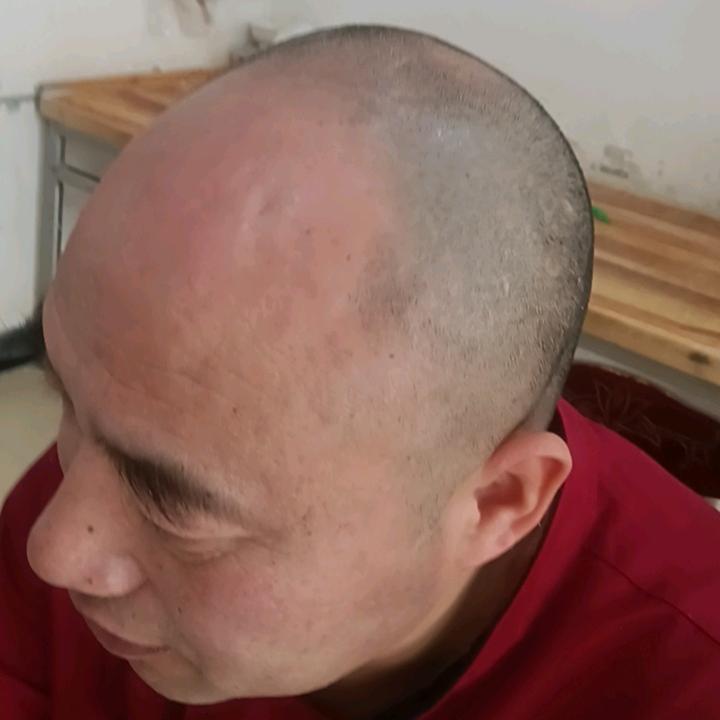 宁陵郭屯海滨(厨师）(养发中)