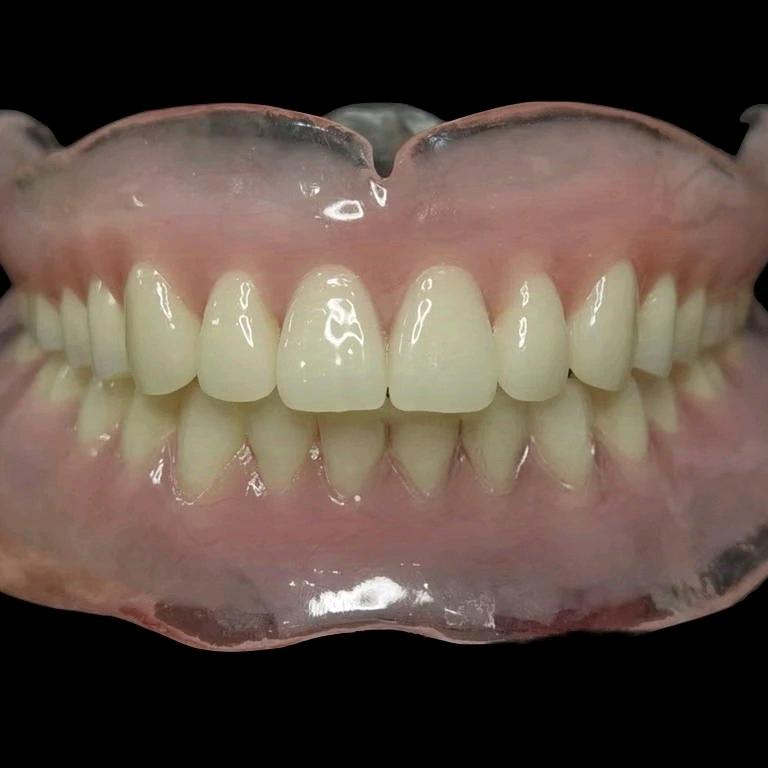 小刚-全口功能吸附性义齿