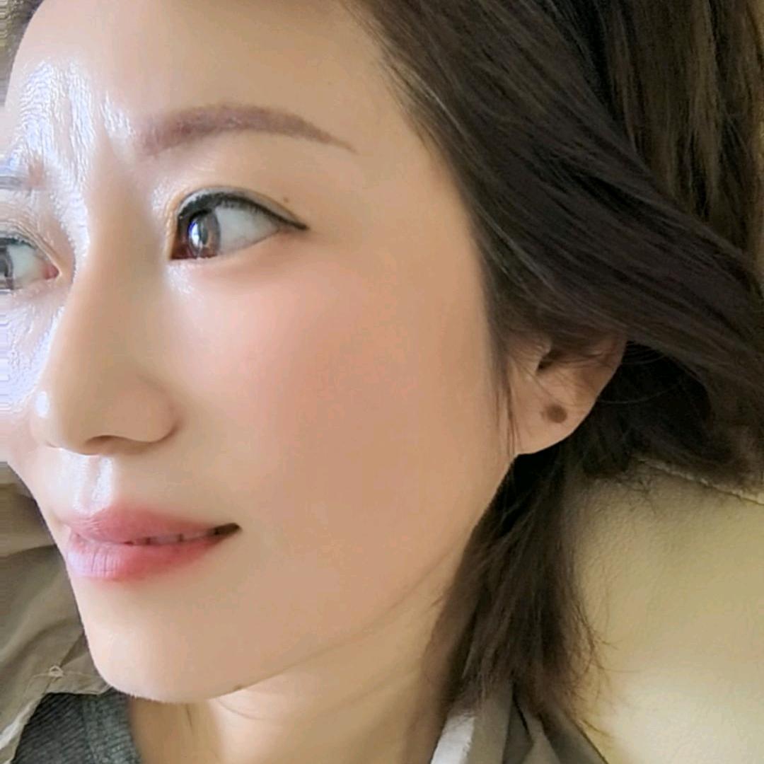 耳朵有痣