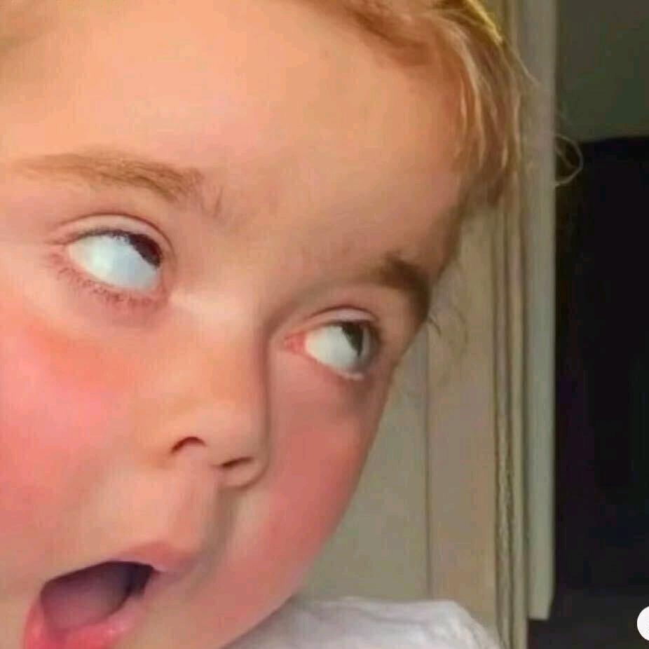 我有黑眼圈 ㅤㅤㅤㅤㅤㅤㅤㅤ