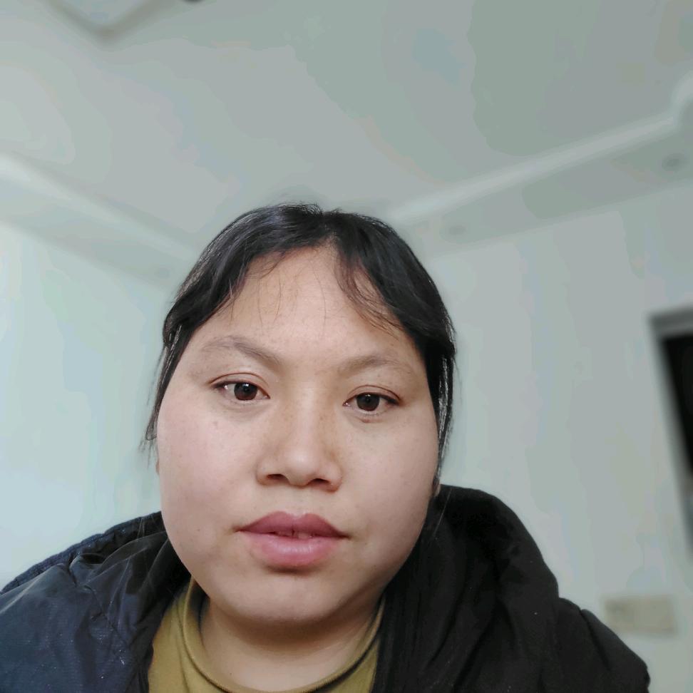 艳姐血透的生活记录