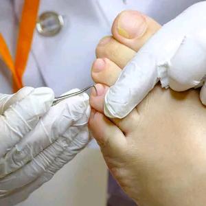 张氏专业修脚足疗