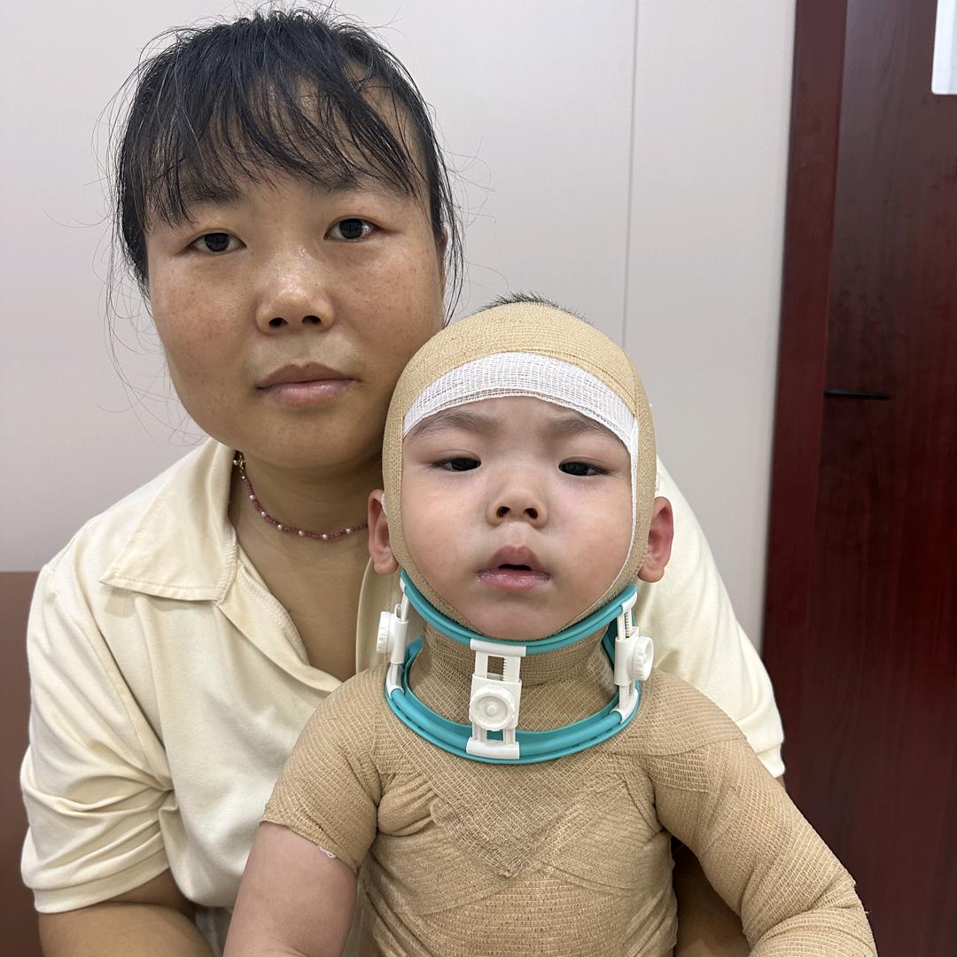 小硕硕的抗疤之路（橱窗已开）