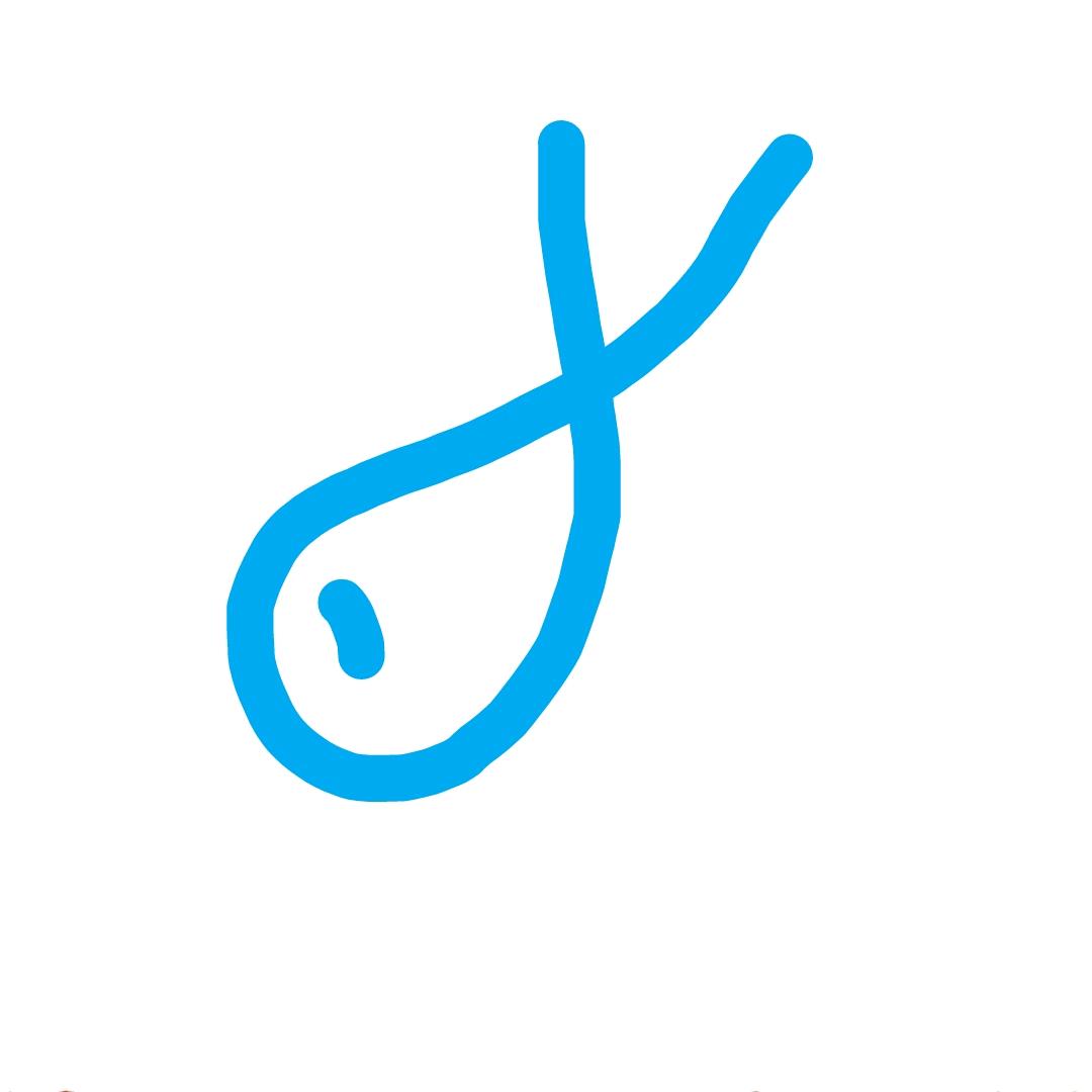 DT