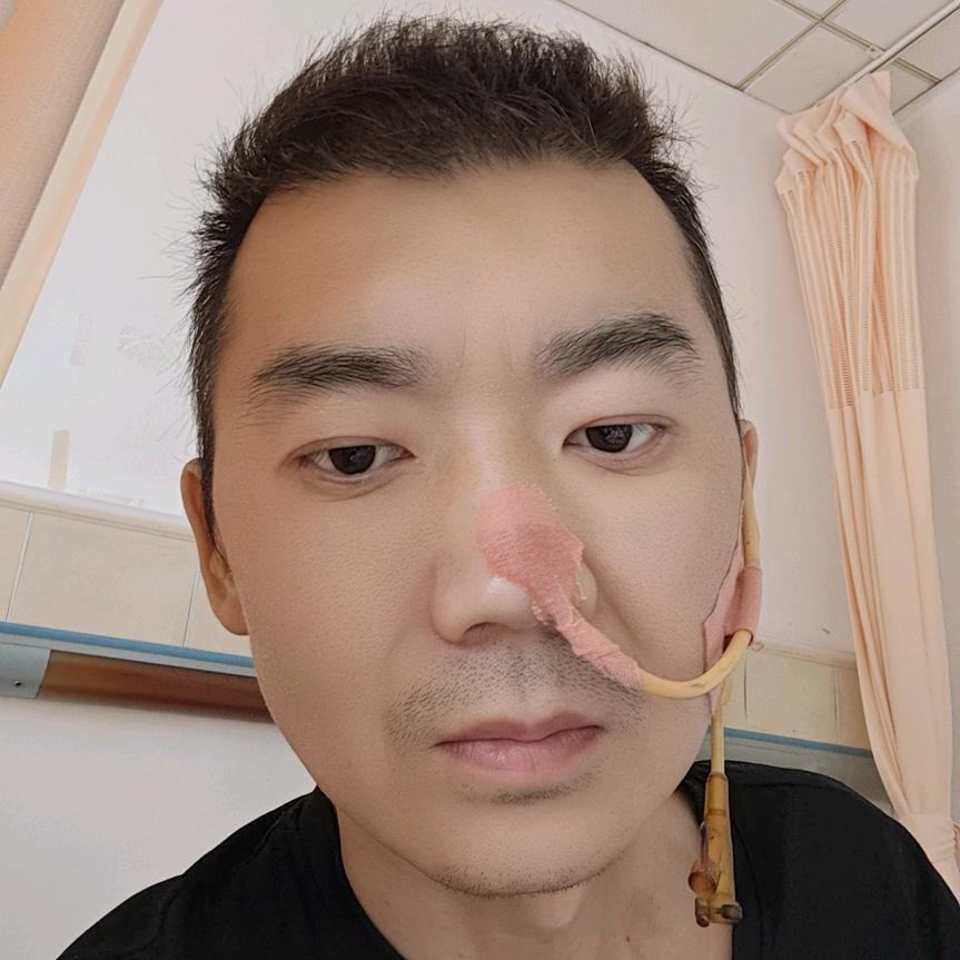 吕杰（重胰恢复中）