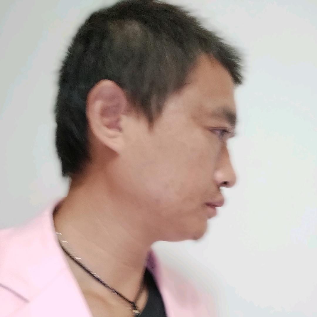 王💞皮♥💞蛋（亿）