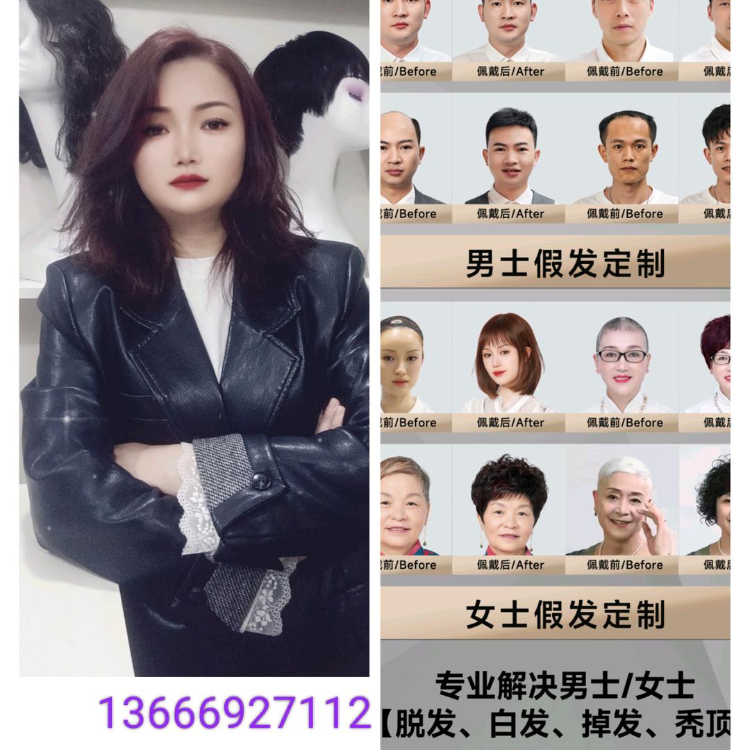 假发定制_阿苗