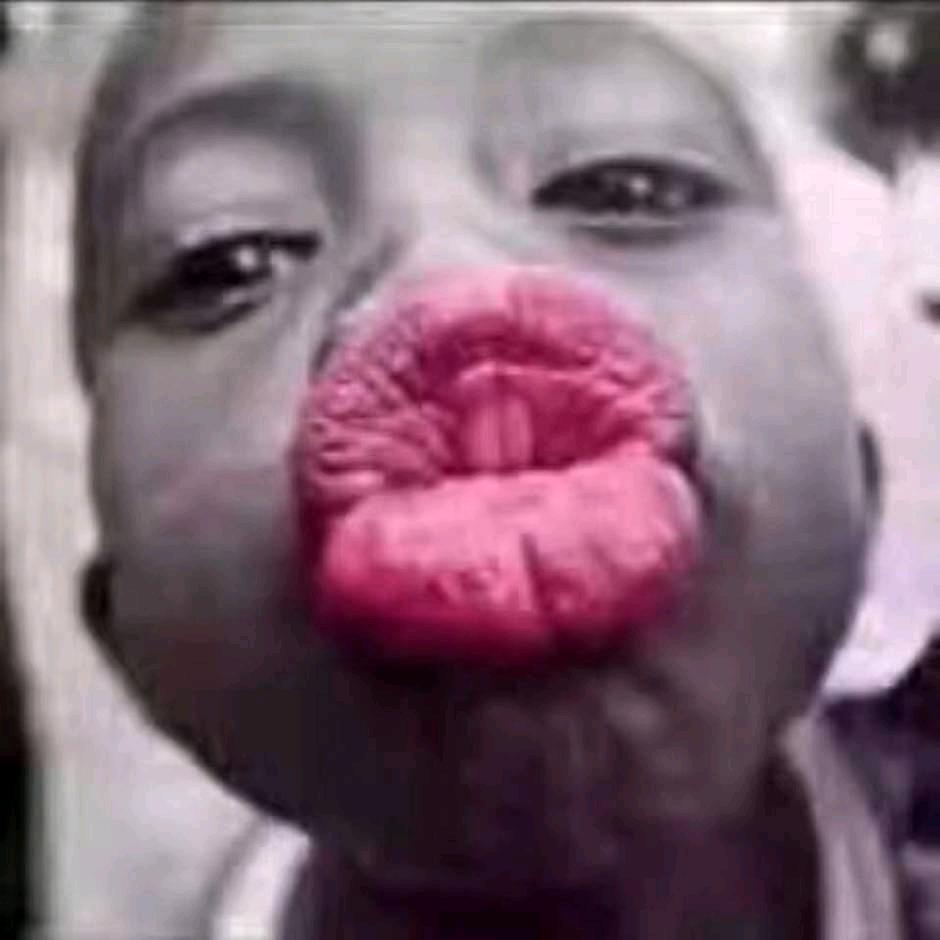 蚂蚁穿上比基尼