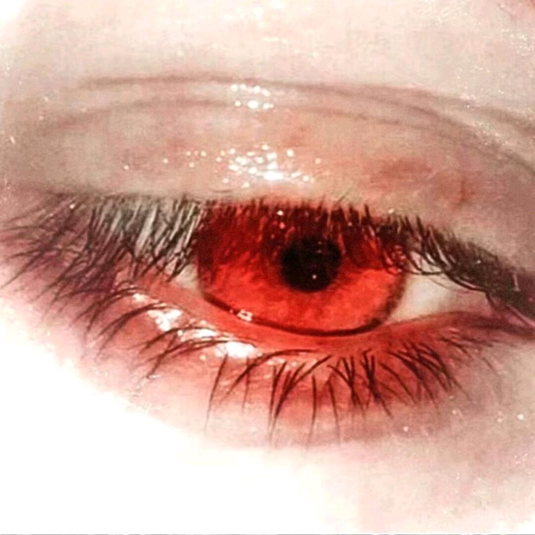 Eye