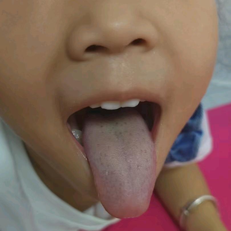 慧慧
