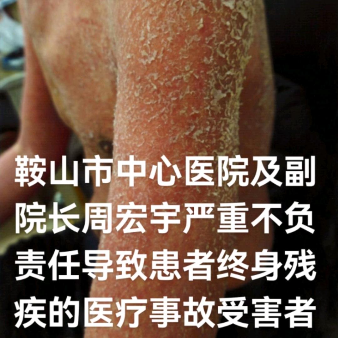 医疗事故受害者