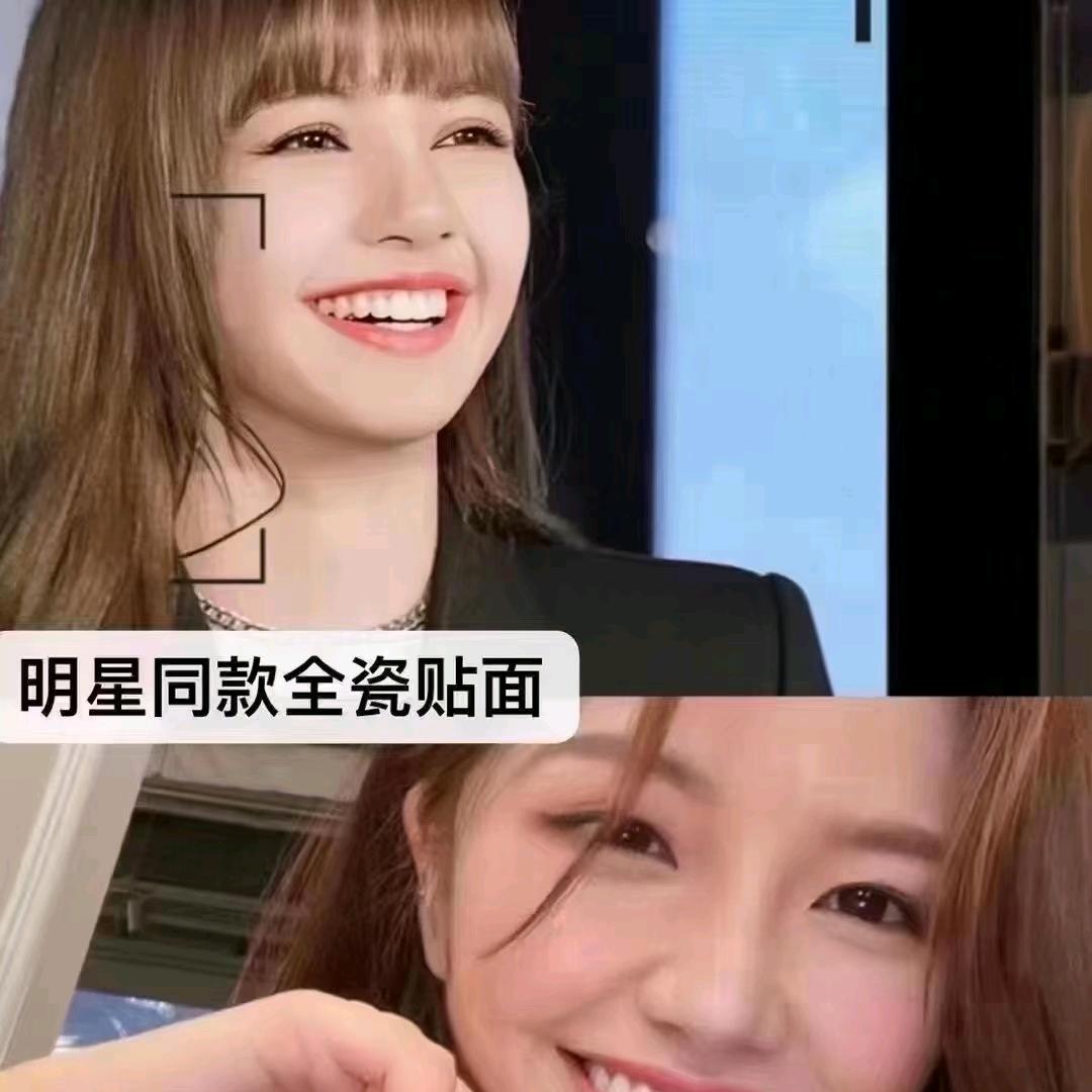 喜牙
