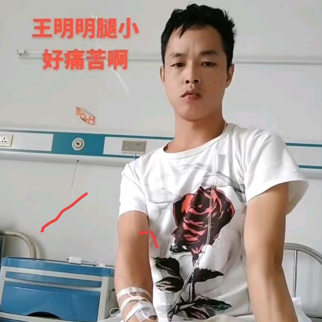 王明明遍体鳞伤