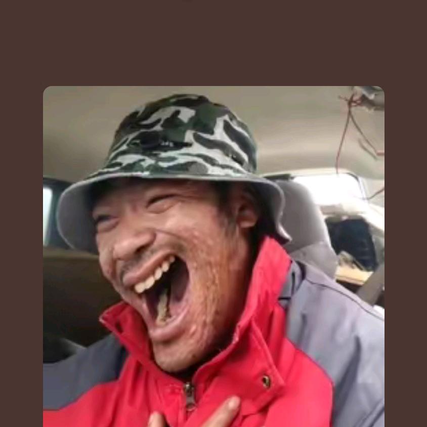 癞疙宝👿