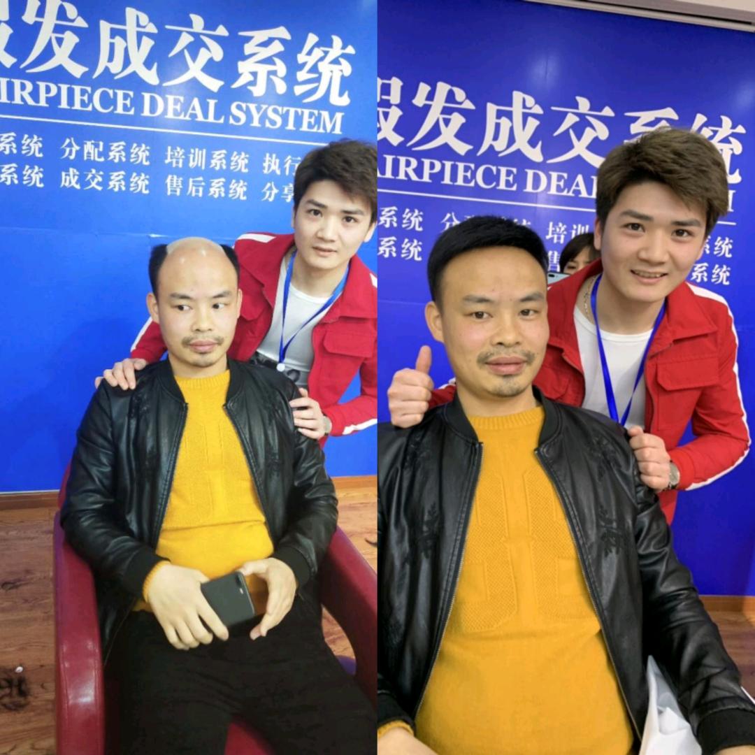 俊波℡高县万达速美假发、接发、收头发