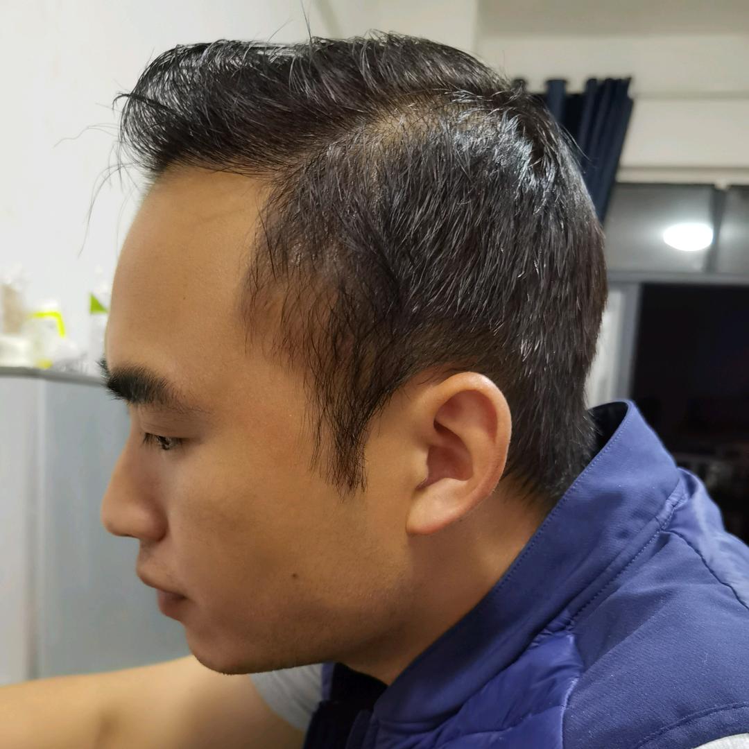 勿忧33