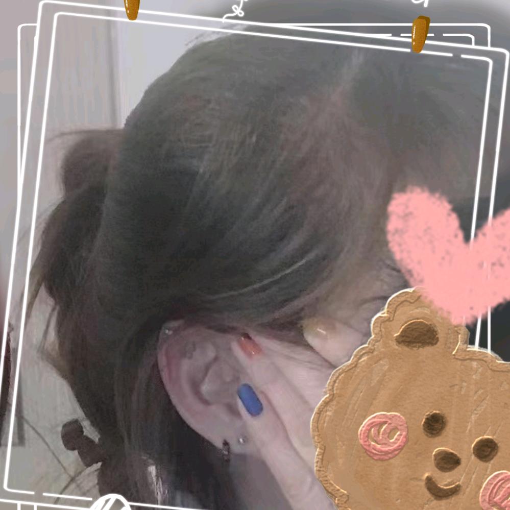 芽蚜