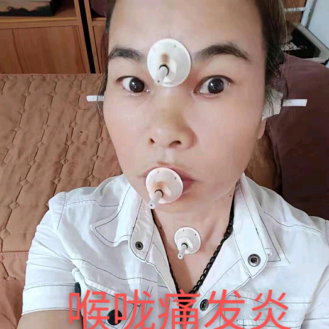 梅衣艾灸