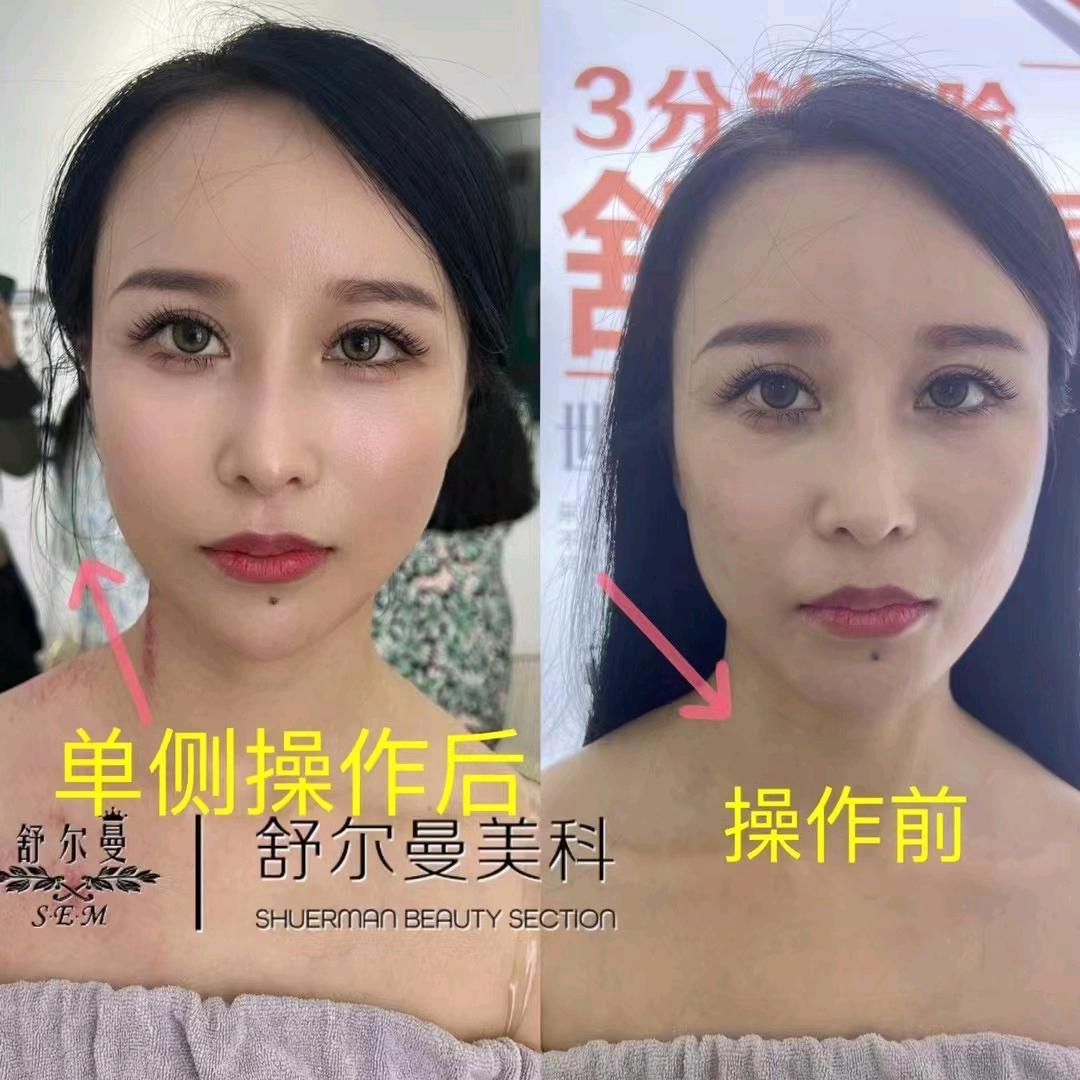 阳阳
