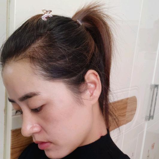 蒋佳