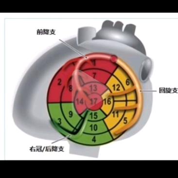 心脏超声
