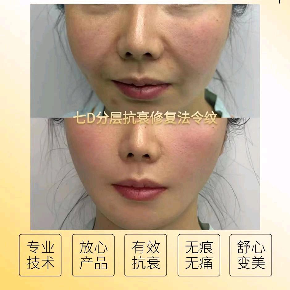 中亚华美肽雕术