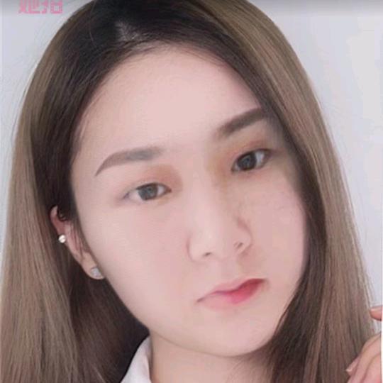 小玲珑