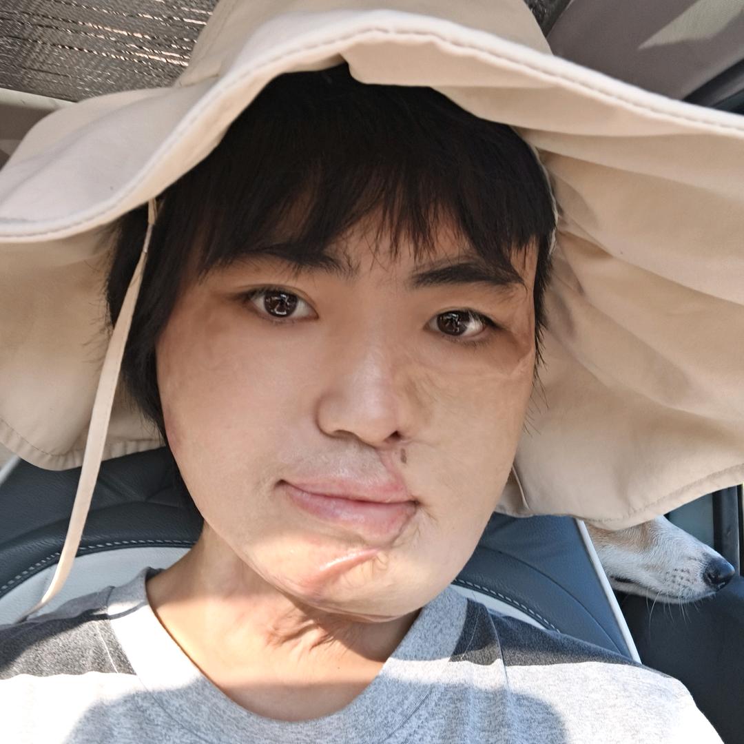 是小陈呢（康复中）