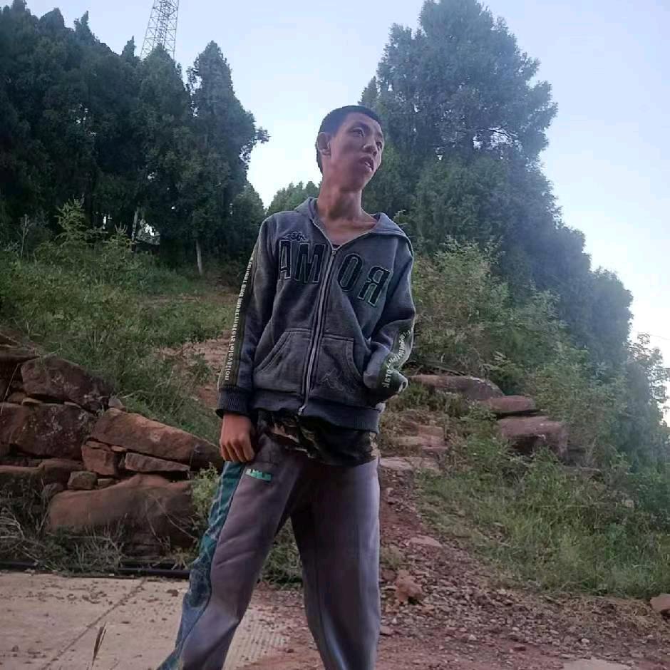 我是一个残疾人沧哥