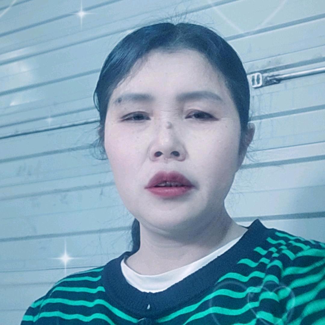 陈菲