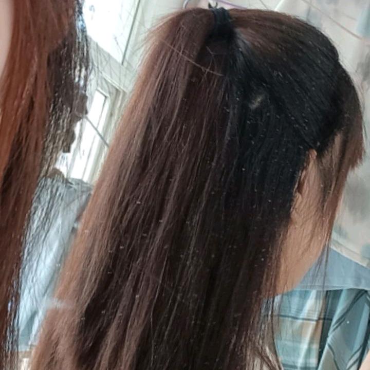 yuan