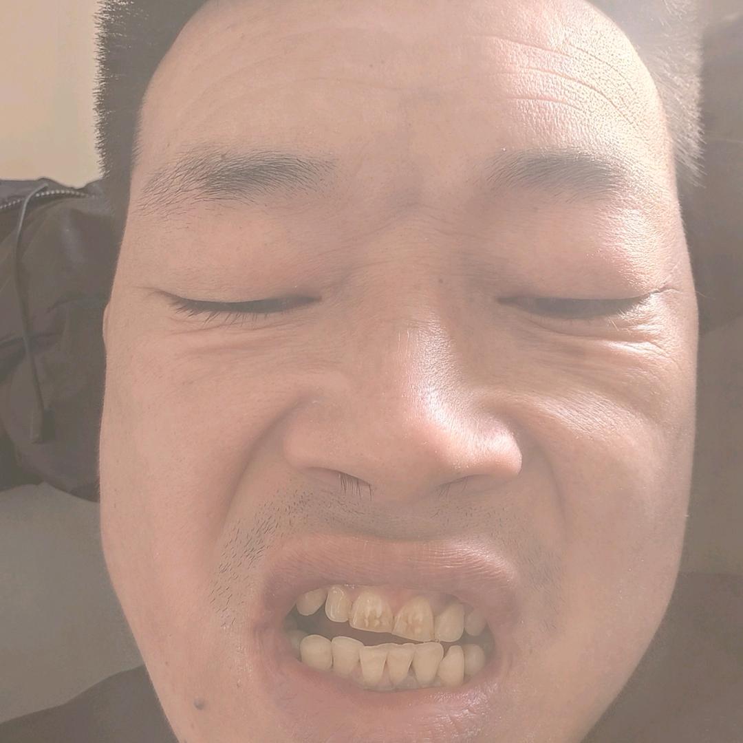 白成付