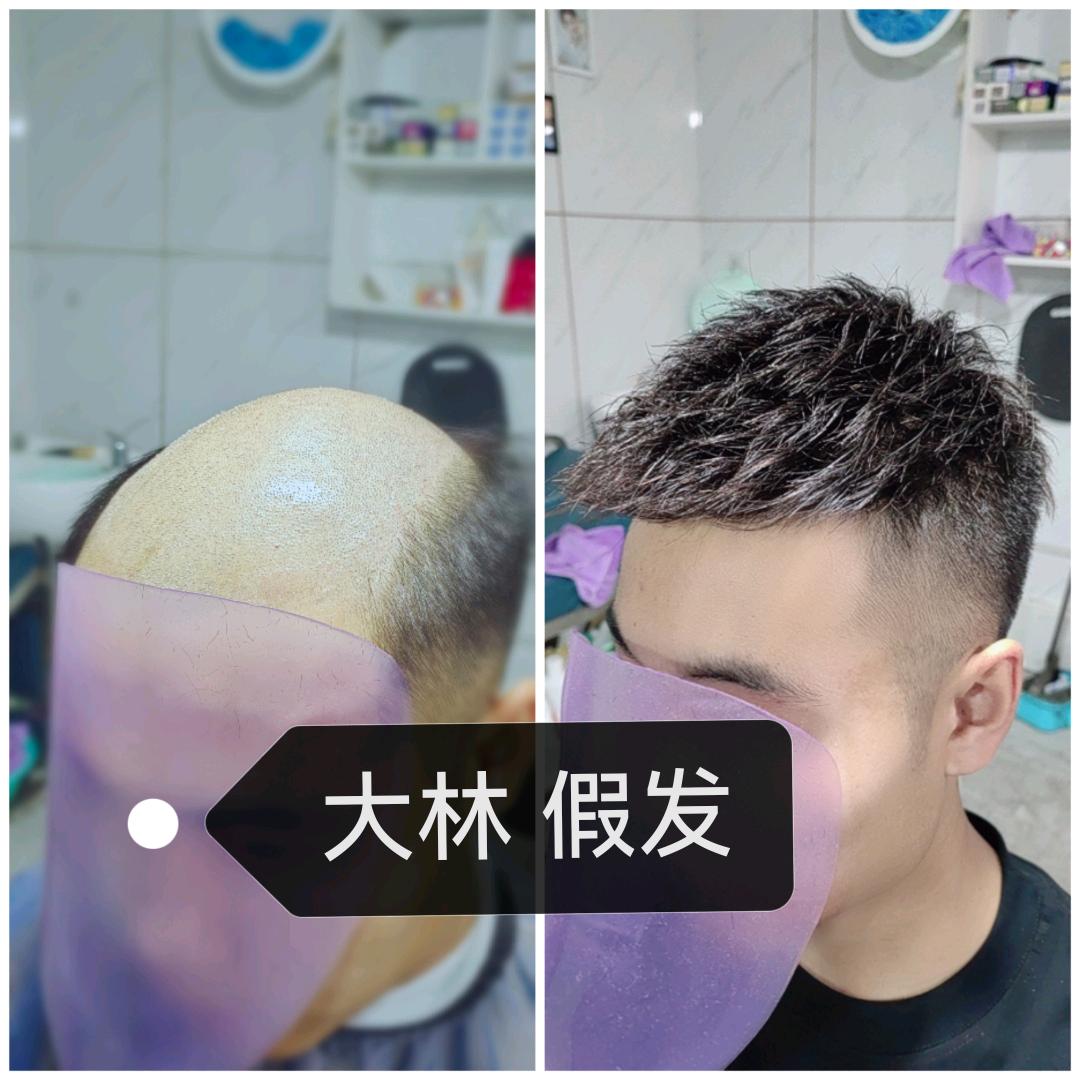 大林假发