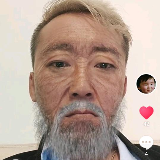 盲肠