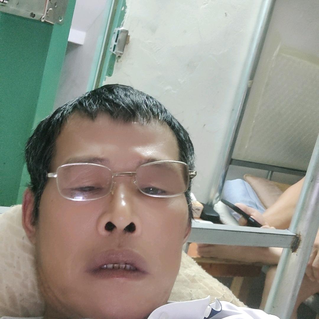 眼