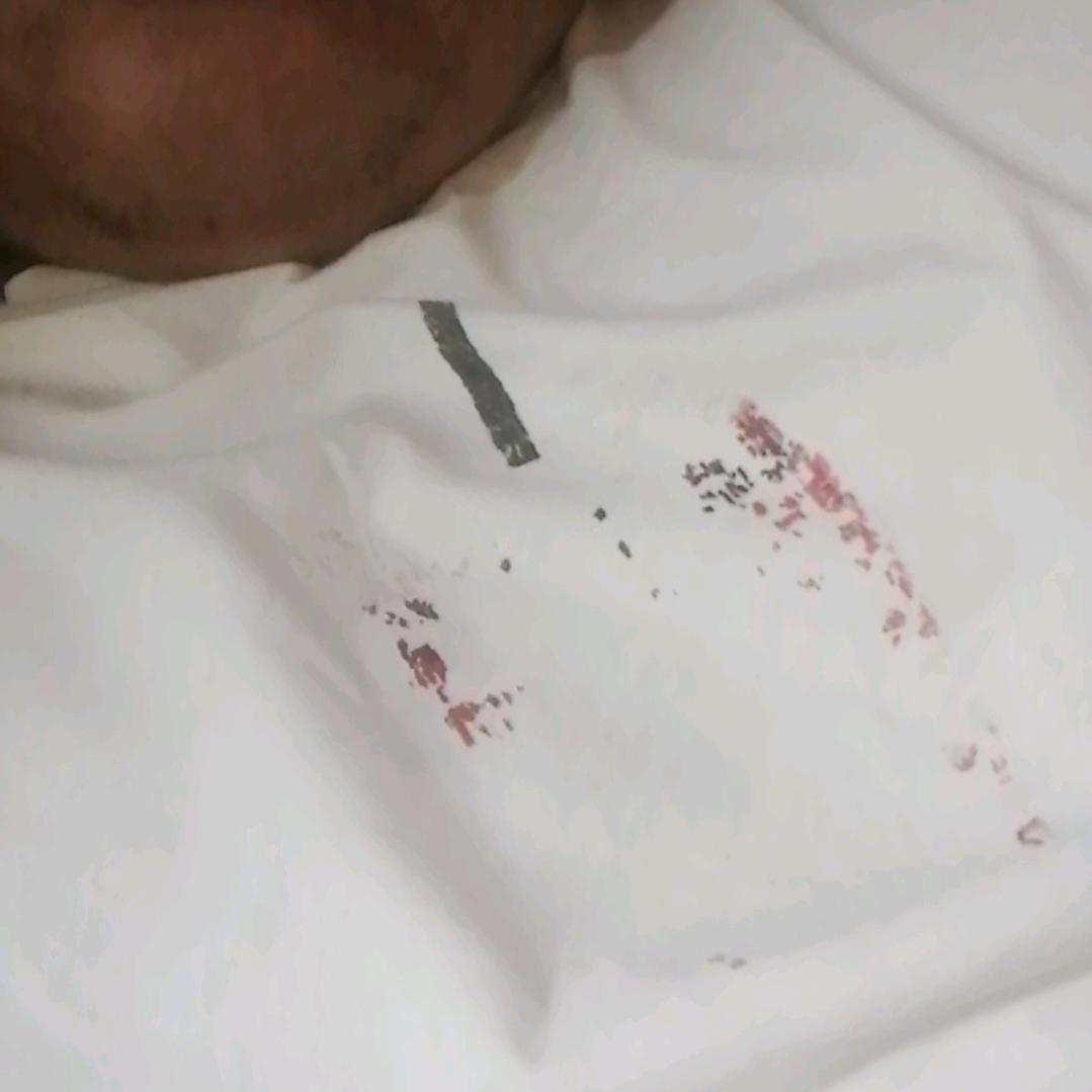 老李