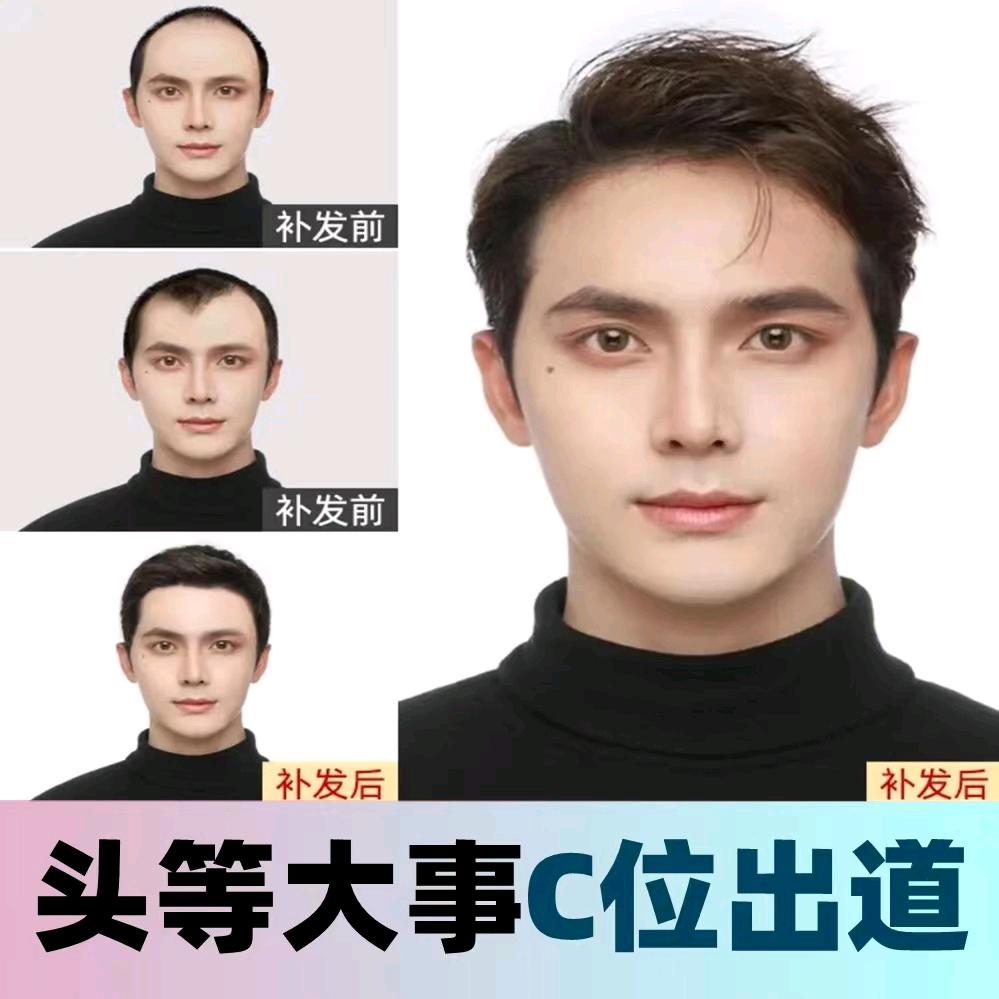 发多多隐形补发假发定制