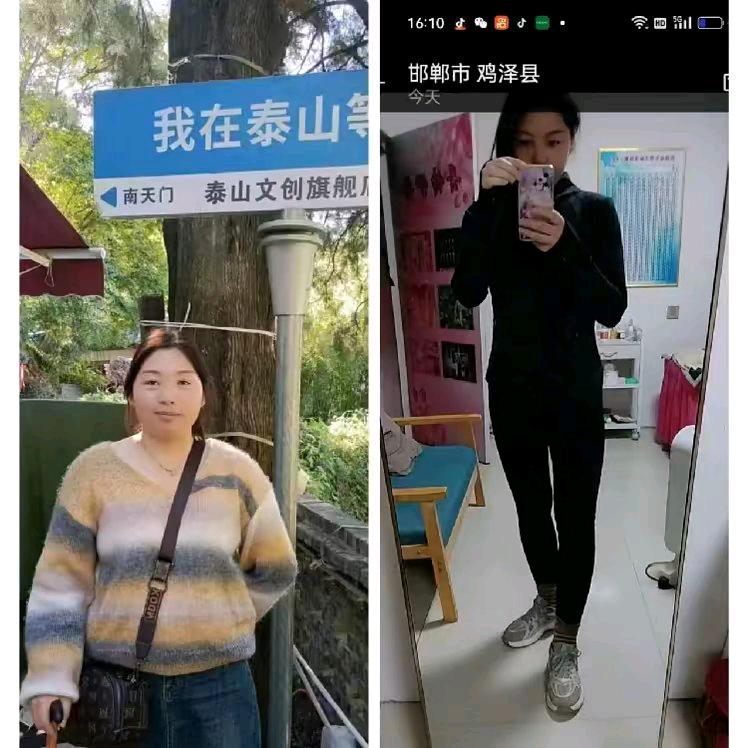 123常瘦专业瘦身(亭自头店)专用号