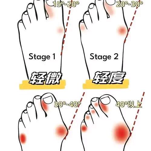 胖姐带你练脚