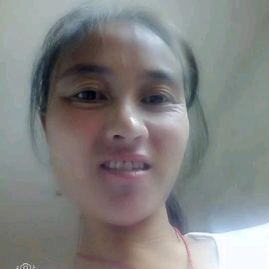 系统性红斑狼疮