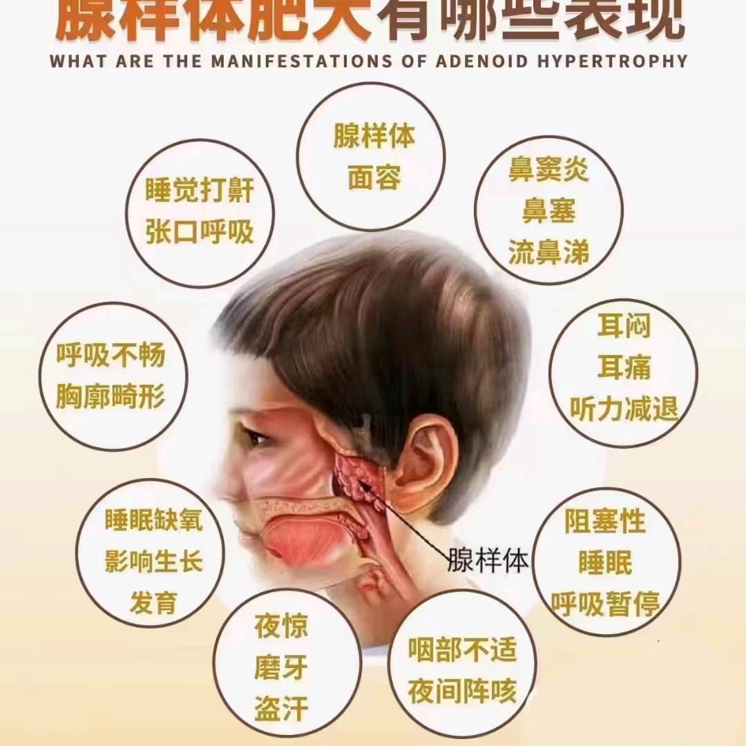 鼻炎玛玛