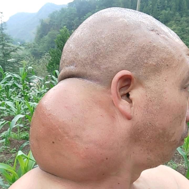 本人是癌症晚期，可能剩下的时间不多了
