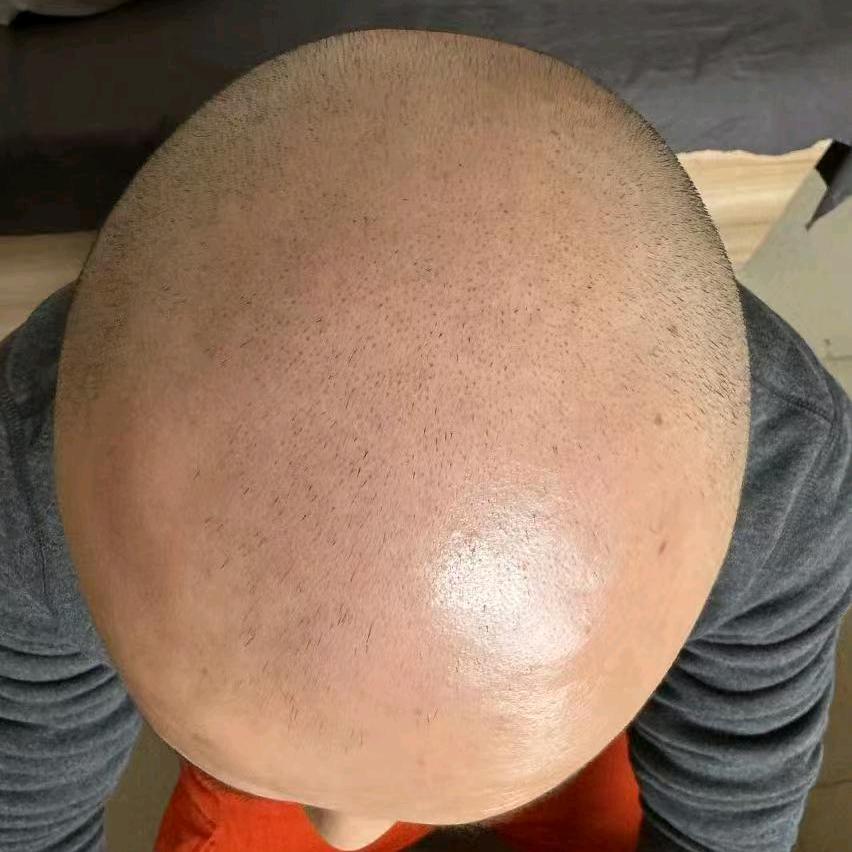 小白 生发记小号（徐峰指导）