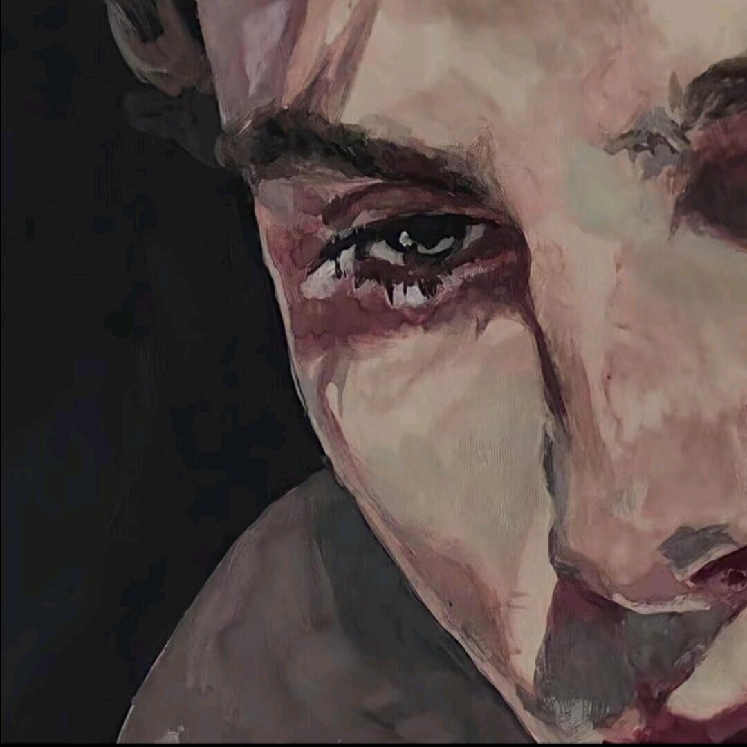 刚做完痔疮手术看视频笑开线 被护工打出屎