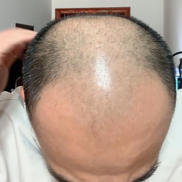 泼昂庞